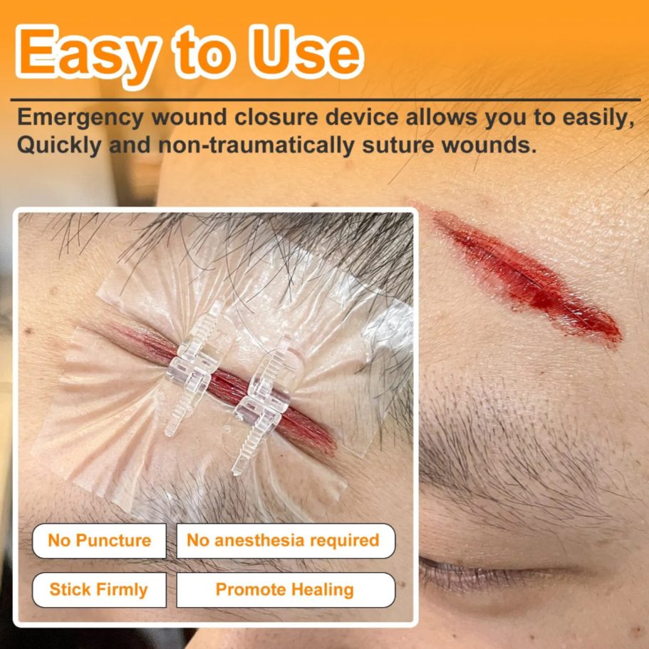 BindMD™ Wound Closure Device