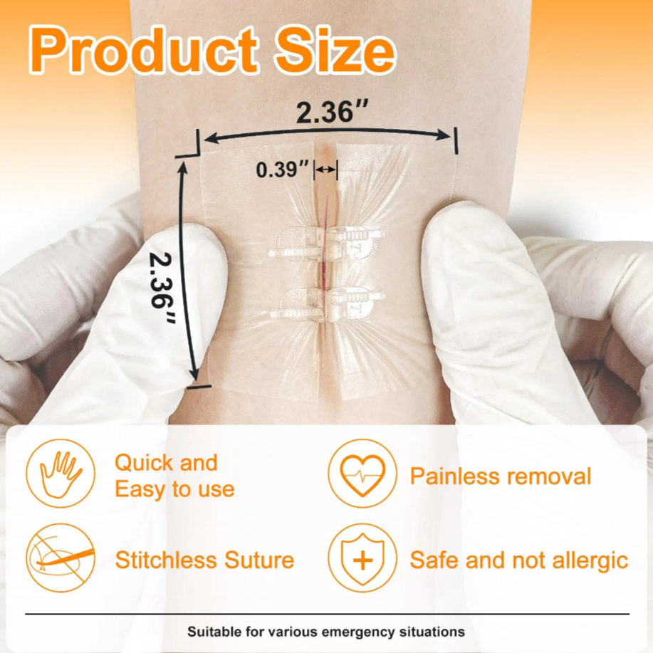 BindMD™ Wound Closure Device