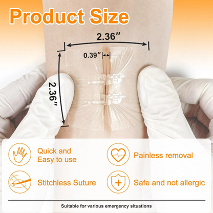 BindMD™ Wound Closure Device