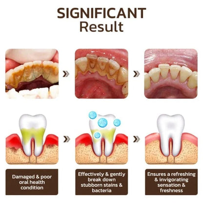 🔥SP-6 Toothpaste Oral Health Management, Fresh Breath